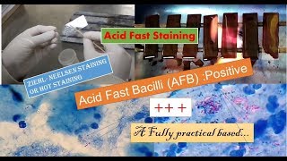 Acid fast staining  AFB stain  Z N staining a fully practical microbiology  afb positive [upl. by Fai]