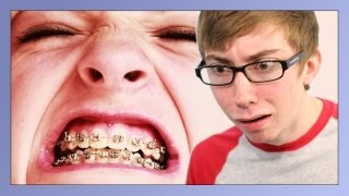 BRACES SUCK [upl. by O'Toole]