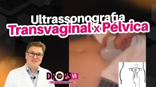 COMO DIFERENCIAR USG TRANSVAGINAL X USG PÉLVICA  VOCÊ RADIOLOGISTA [upl. by Adnoluy]