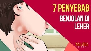 Ada benjolan di leher Waspadai 7 Penyebab Benjolan di Leher Ini [upl. by Ahs169]