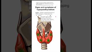 Signs and symptoms of hypoparathyroidism [upl. by Kiel]