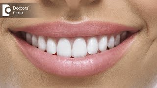 Can Porcelain Veneers stain over time  Dr Sangeeta Honnur [upl. by Noval45]