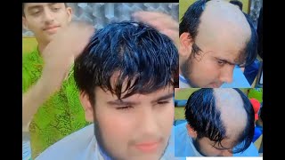 Headshave How to remove headshave dandraf 😱tindheadshave hairstyle [upl. by Glogau143]