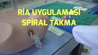 Spiral RİA Uygulaması Nasıl Yapılır [upl. by Yelda]