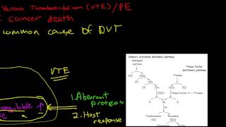 Oncologic Emergencies Venous Thromboembolism [upl. by Beaudoin]