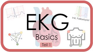 EKG Basics  Step by Step  Grundlagen Einthoven Frequenz Lagetyp PWelle QRS EKGKurs [upl. by Aloeda]