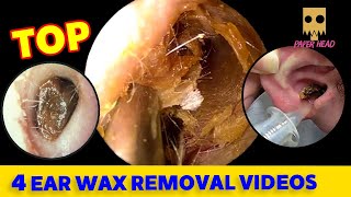 ear wax removal ear wax removal  ear wax cleaner  best way to remove ear wax [upl. by Gayelord]