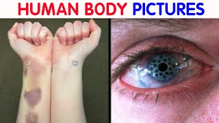 “My Eye Is Gradually Losing Its Color” 50 Interesting Human Body Pics [upl. by Dlnaod]