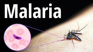 Malaria Explicado Claramente [upl. by Gelhar]