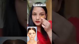 dark circles under eyes home remedy। dark circle removal। Dark circle treatment beautyhacks shorts [upl. by Enilehcim]