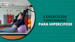 5 Exercícios funcionais para Hipercifose [upl. by Eyatnod]