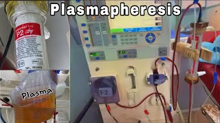 What is Plasmapheresis  Plasma Exchange  Plasmapheresis Dialysis  plasma therapy [upl. by Carlita214]