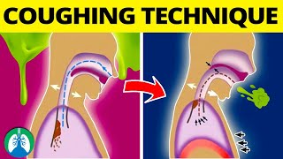 This COUGHING Technique Can Help Get Rid of Mucus and Phlegm ❗ [upl. by Levana]