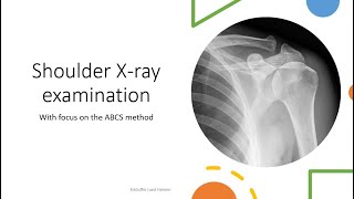 Shoulder Xray interpretationexamination ABCS method [upl. by Nadabus]