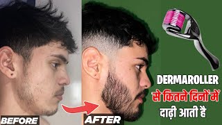 dermaroller से कितने दिनों में दाढ़ी आती है  कब यूज करें  Derma roller for beard growth  beard [upl. by Ettevey980]