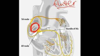 Atrial Flutter  Dr Jamal USMLE [upl. by Avonasac491]