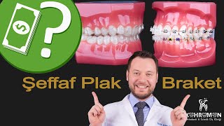 Fiyat Karşılaştırması Invisalign Şeffaf Plak Tedavisi vs Diş Teli  Braket  ile Ortodontik Tedavi [upl. by Relyuc]