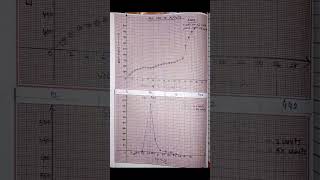 Potentiometric Titration of Fe2 with K2Cr2O7 chemistryexperiments [upl. by Gerita]