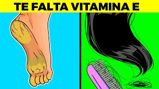 SEÑALES DE QUE TE FALTA VITAMINA E Y NO SABÍAS [upl. by Acimat560]