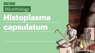 Histoplasma capsulatum  USMLE Step 1  Sketchy Medical [upl. by Okeim458]