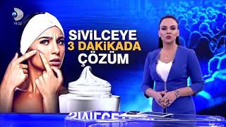 Sivilceye karşı 3 dakikada kesin cözüm [upl. by Nalla]