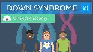 Down Syndrome Definition causes symptoms diagnosis  Kenhub [upl. by Milt]