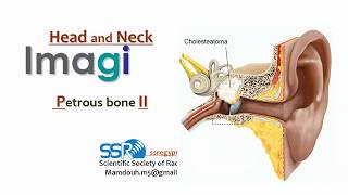 6 Petrous Bone  part 2  profMamdouh Mahfouz 2019 edition [upl. by Eceinej]