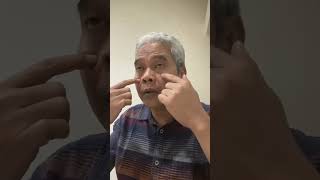 SINUSITIS  PART 3 shorts short dranton antonbudiasih rsbudiasih [upl. by Reve]