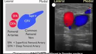 Comment  Étude de cas sur la détection dune thrombose veineuse 1 [upl. by Seldan625]