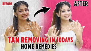 Remove Tan at HOME In Just 1 WEEK 😱  HOME REMEDY [upl. by Leif513]