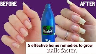 How I Whiten And Grow My Nails At Home Naturally l Faster Nail Growth In Just 3 Days lremedy tips [upl. by Nostrebor270]