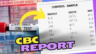 CBC Blood Test Results How to Read and Understand Your Results [upl. by Bria]