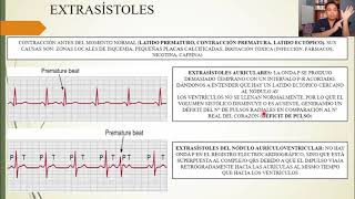 FISIOLOGÍA ARRITMIAS CARDIACAS y SU INTERPRETACIÓN ELECTROCARDIOGRÁFICA [upl. by Fiedling775]