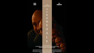 Acromegaly short film Trailer [upl. by Ihab]