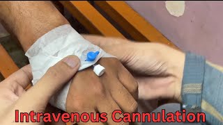 IV Cannulation  intravenous Cannulation  cannula Fix  vigo kese lagate hain [upl. by Eibot]