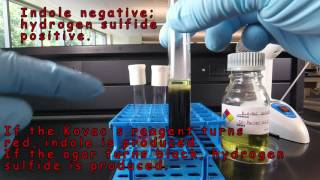 SIM Medium Detection of Indole and Hydrogen Sulfide Production [upl. by Ellirpa1]