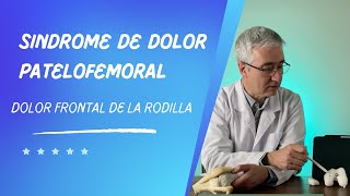 Sindrome de Dolor Patelofemoral ¿porqué se produce [upl. by Ahsael]